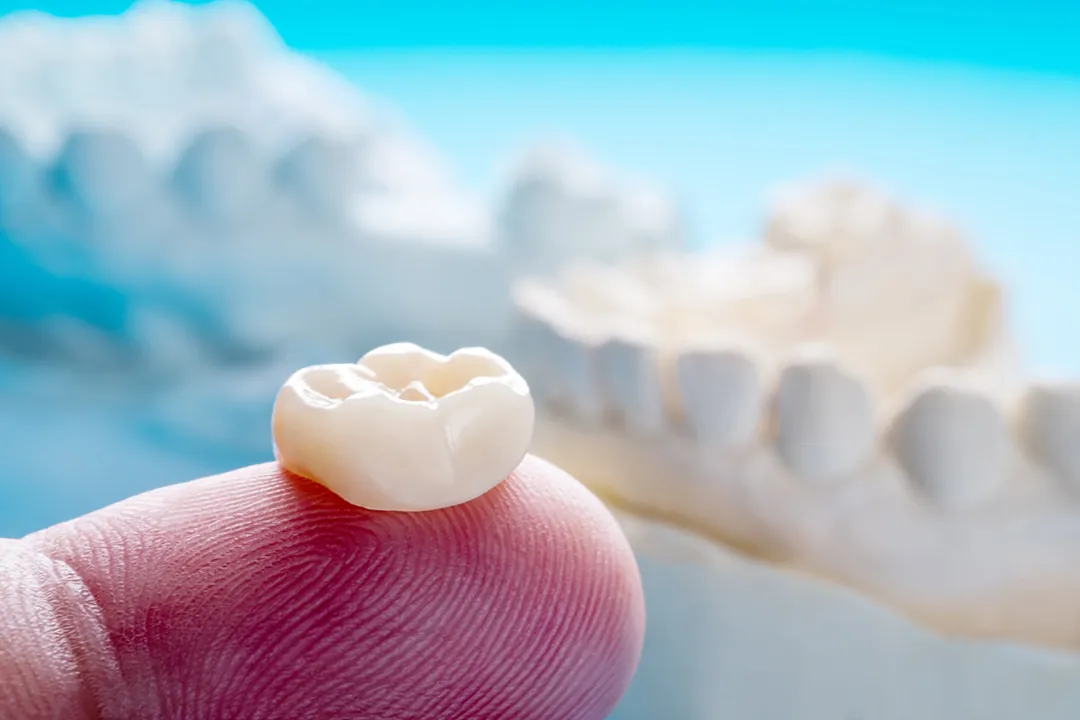 Tooth-colored dental crown resting on a fingertip in front of a dental model